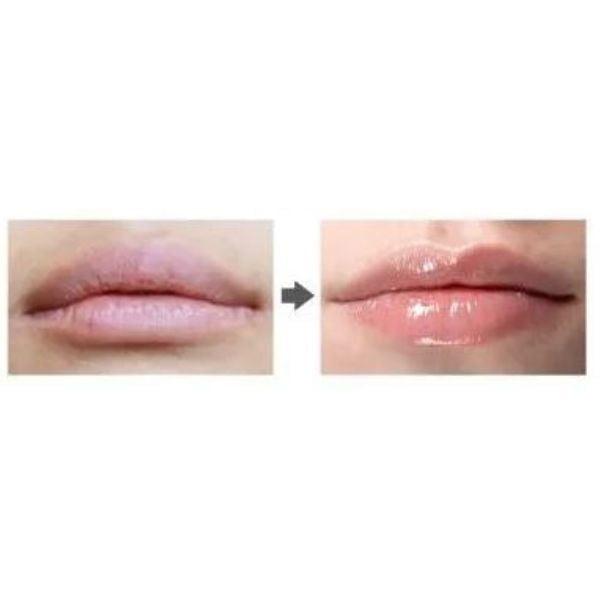 MIZON Collagenic Aqua Volume Lip Essence SPF15 10ml - Balsamo labbra 3 MIZON Collagenic Aqua Volume Lip Essence SPF15 10ml - Balsamo labbra
