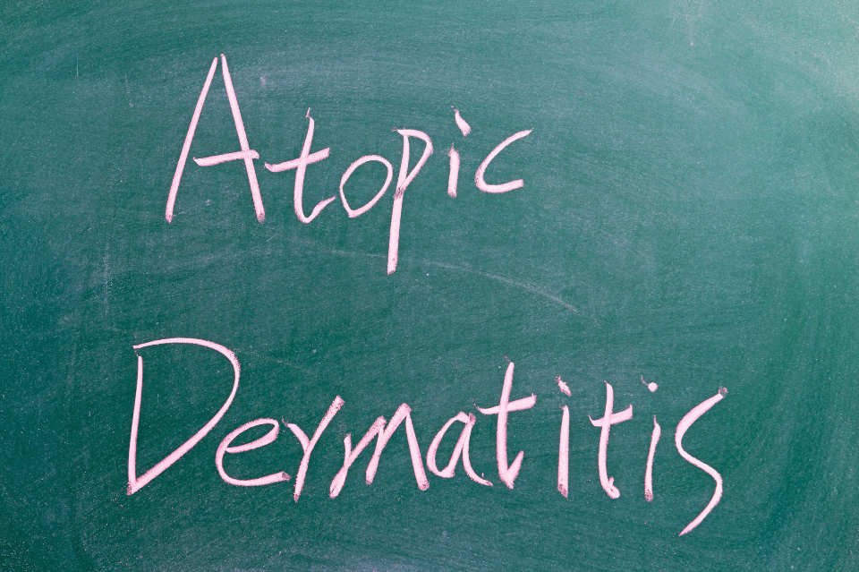 cosmetici per dermatite atopica