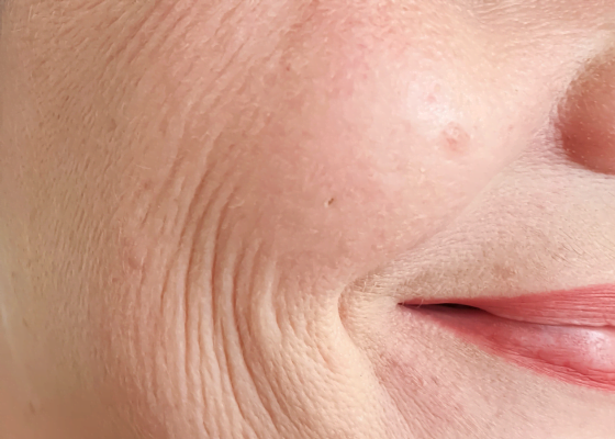 rughe | Skincare per rughe