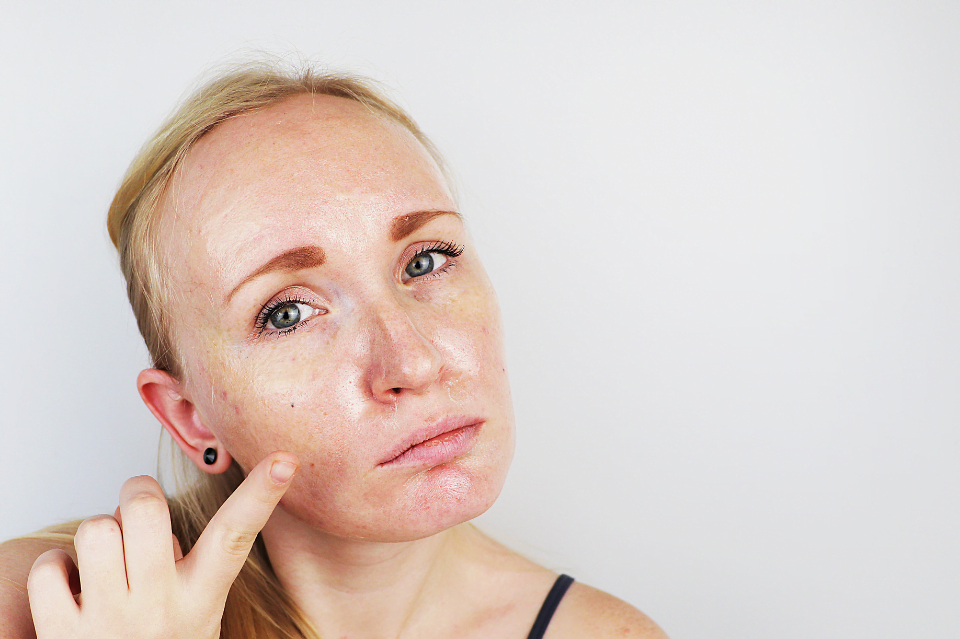 Cosmetici seboregolanti per pelli grasse e impure 1 cosmetici seboregolanti
