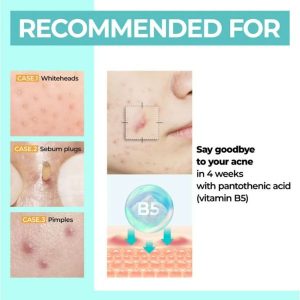 NUMBUZIN No.1 Pantothenic B5 Active Soothing Cream recommended for