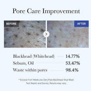 MEDICUBE Zero Pore Blackhead Mud Mask 100g 13 MEDICUBE Zero Pore Blackhead Mud Mask benefits