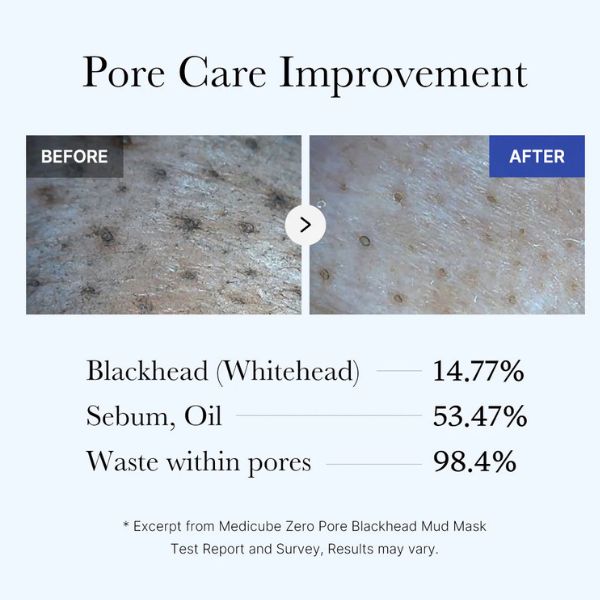 MEDICUBE Zero Pore Blackhead Mud Mask 100g 7 MEDICUBE Zero Pore Blackhead Mud Mask benefits