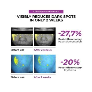 JUMISO Niacinamide 20 Serum finish benefit