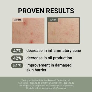 JUMISO Snail Mucin 88 + Peptide Facial Cream benefits 2