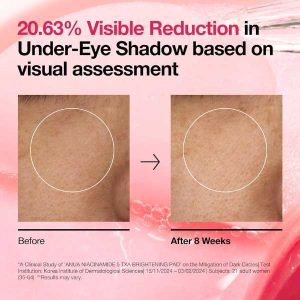 ANUA Niacinamide 5 TXA Brightening Pad benefits 2