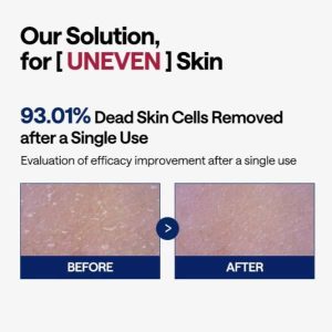 MEDIHEAL Phyto-enzyme Peeling Pad 100pcs 13 MEDIHEAL Phyto-enzyme Peeling Pad HOW IT WORKS
