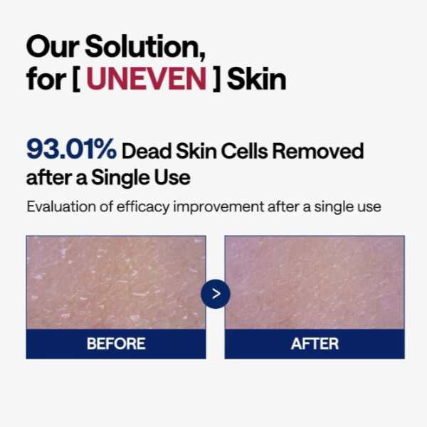 MEDIHEAL Phyto-enzyme Peeling Pad 100pcs 6 MEDIHEAL Phyto-enzyme Peeling Pad HOW IT WORKS