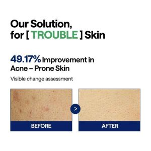 MEDIHEAL Teatree Trouble Pad HOW IT WORKS