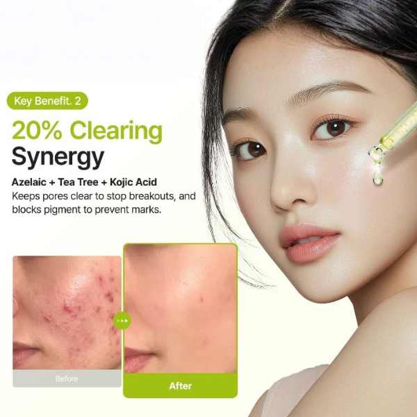 PURITO SEOUL Azelaic Acid 10 Kojic Tea Tree Serum 30ml 5 PURITO SEOUL Azelaic Acid 10 Kojic Tea Tree Serum benefits