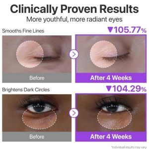 NUMBUZIN No.9 NAD+ Retinol Volumetox Eye Cream benefits