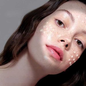 VT COSMETICS Reti-A Reedle Shot 100 finsh
