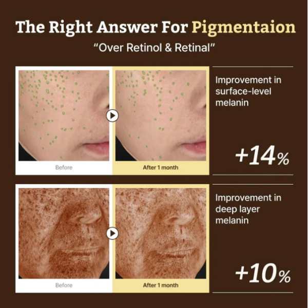 Dr. Reju-All Advanced Retino-Mela Serum 30ml 9 Dr. Reju-All Advanced Retino-Mela Serum benefits 2