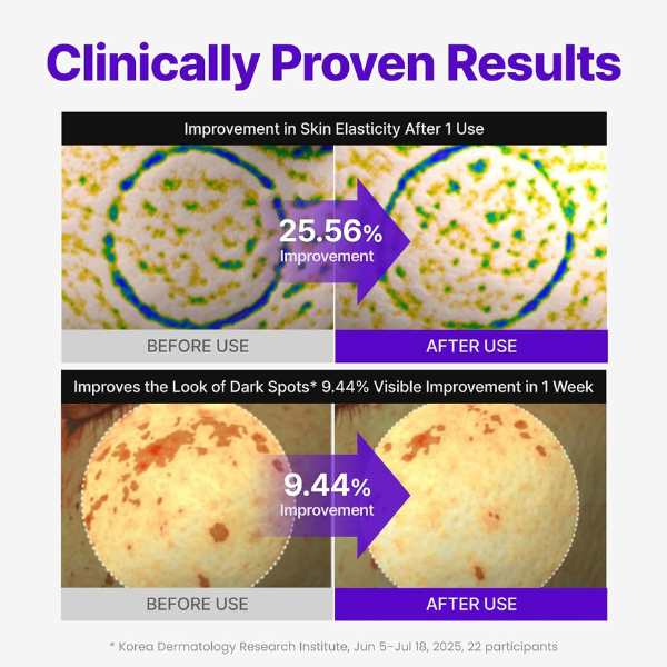 CENTELLIAN24 Expert Madeca Cream Active Renew PDRN 50ml 7 CENTELLIAN24 Expert Madeca Cream Active Renew PDRN benefits