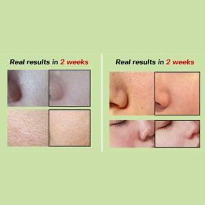 SUNGBOON EDITOR Green Tomato NMN Pore Lifting Ampoule benefits
