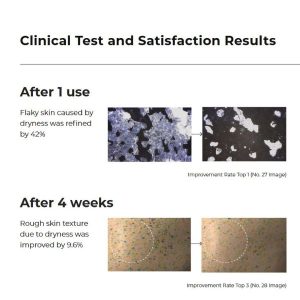 AESTURA Atobarrier 365 Lotion 150ml 13 AESTURA Atobarrier 365 Lotion benefits 3