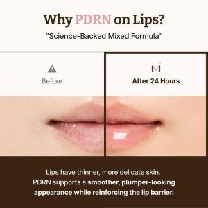DR. REJU-ALL Advanced PDRN Rejuvenating Lip Serum BENEFITS 3