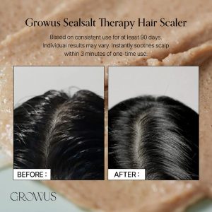 GROWUS Sea Salt Therapy Scalp Scaler benefits