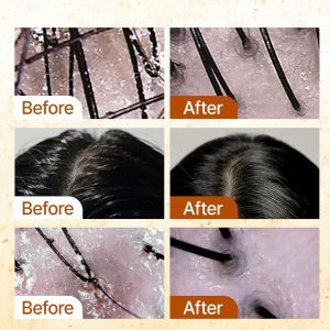 GROWUS Sea Salt Therapy Shampoo benefits 2