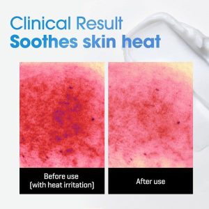 SOMEBYMI Beta Panthenol Repair Body Cream benefits 2