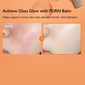 GENABELLE PDRN Enriched Recovery Balm skin benefits