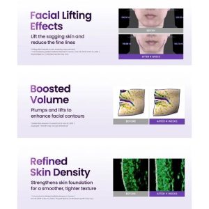 BIOHEAL BOH Probioderm 3D Lifting Cream benefits